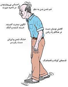 پارکینسون